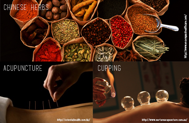 The various types of treatment available in TCM, chosen based on what's most suitable for your body