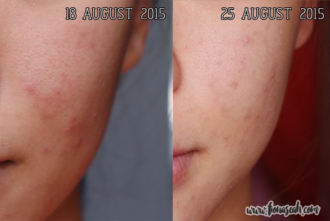 Side-by-side comparison