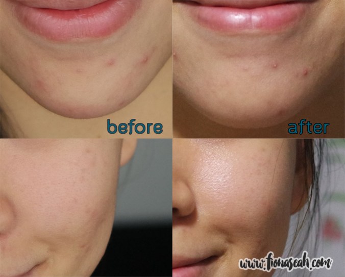 A quick before and after comparison