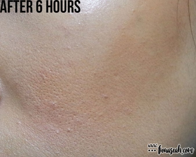 After 6 hours of wear (close-up)