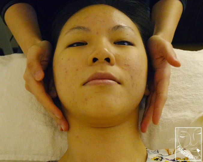 Preparing to receive the therapy