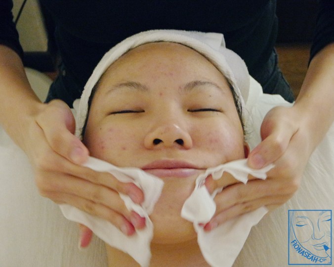 Wiping off the cool gel in preparation for the next part of Sygmalift