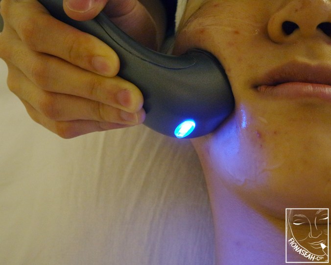 From this picture, you can tell roughly how much pressure is exerted onto my face