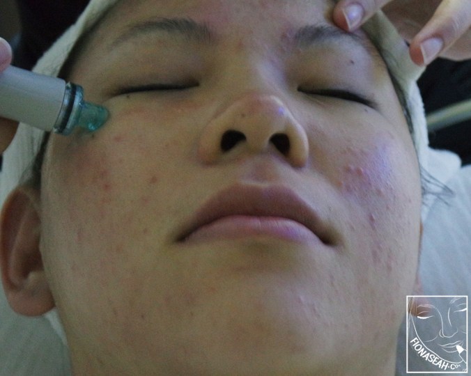 Absolutely pain-free!