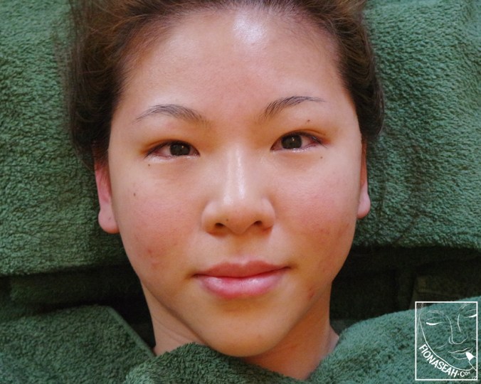 Still recovering from tears