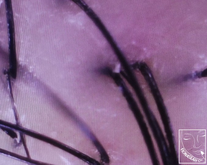 More grease on my scalp