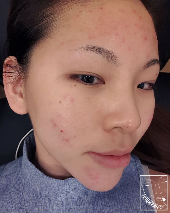 All ready to be AGNES'd!