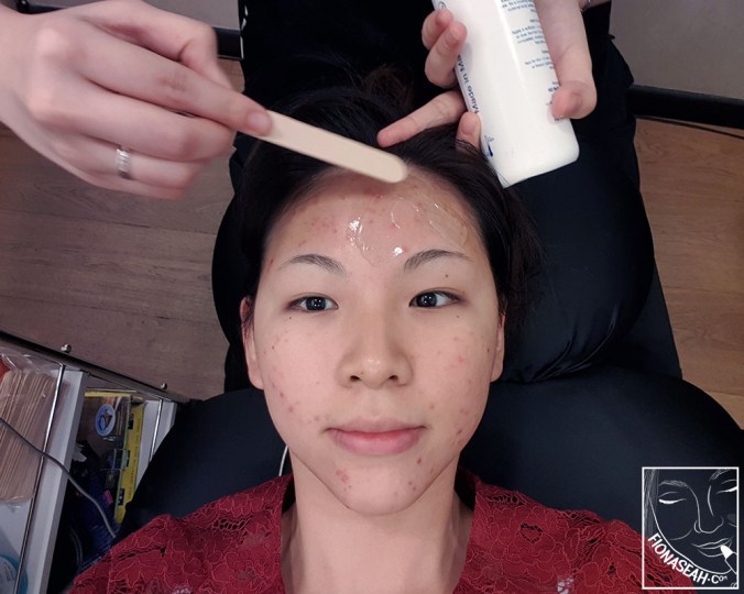 Applying electrode gel