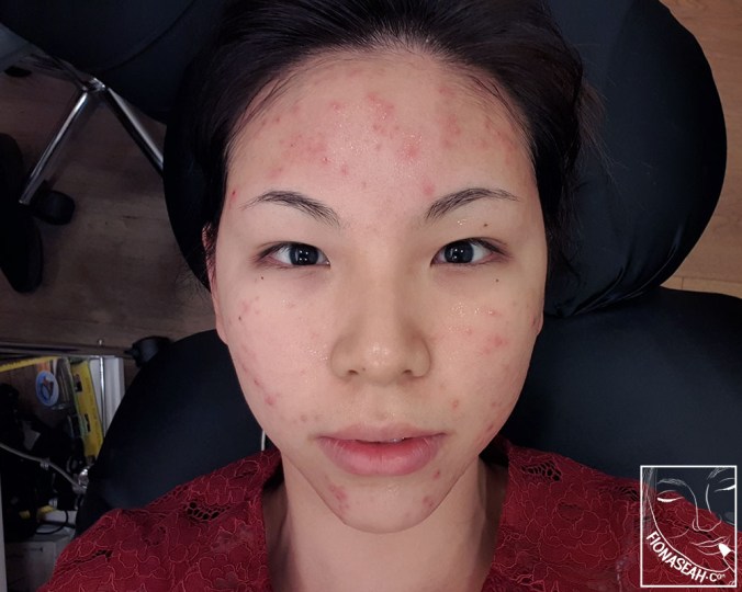 Face became slightly redder