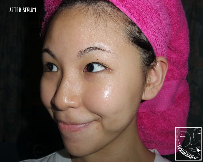 After applying the serum