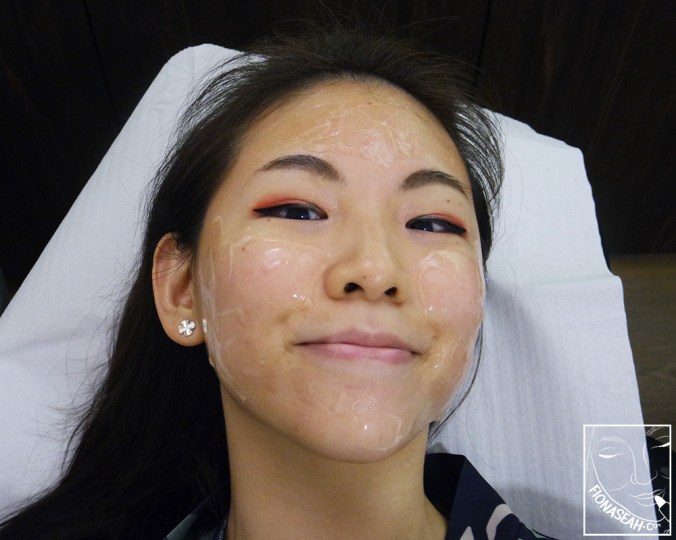 A picture showing my entire face slathered with cooling gel that was taken during my second session!